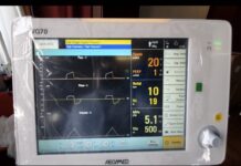 ZTE: donati alla Protezione Civile Nazionale 5 respiratori per la terapia intensiva