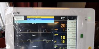 ZTE: donati alla Protezione Civile Nazionale 5 respiratori per la terapia intensiva